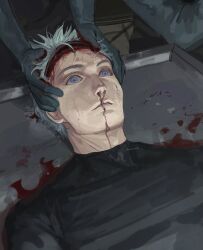 1boy black_shirt blood blue_eyes death gojou_satoru guro highres jujutsu_kaisen lobotomy male_focus novalise1 shirt spoilers surgery white_hair