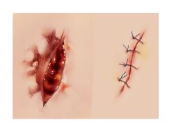 23i2ko art_study before_and_after blood border close-up deep_wound exposed_fat guro injury original smeared_blood still_life stitches white_border