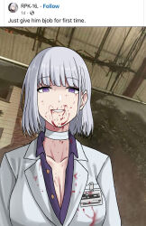 1girl absurdres bandaged_neck bandages blood blood_on_breasts blood_on_clothes blood_on_face breasts character_name cleavage collared_shirt commentary dwi_c english_commentary english_text eyebrows_hidden_by_hair facebook girls&#039;_frontline highres id_card jacket meme official_alternate_costume parted_lips photo_background purple_eyes purple_shirt rpk-16_(girls&#039;_frontline) rpk-16_(renate)_(girls&#039;_frontline) shirt short_hair smile solo straight-on stray_pubic_hair upper_body white_hair white_jacket