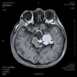 1girl absurdres angel brain circle cross-section halo highres original self_continuity solo spot_color wings x-ray_film
