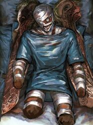 1boy amputee bandage_over_one_eye bandaged_arm bandaged_head bandaged_leg bandages blonde_hair blue_eyes body_horror bonley curly_(mouthwashing) curly_(post-crash)_(mouthwashing) curly_(pre-crash)_(mouthwashing) disfigured exposed_muscle highres hospital_gown looking_at_viewer male_focus mouthwashing no_skin quadruple_amputee short_sleeves skinless skinned solo symbolism teeth