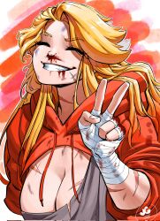 1girl blood blood_on_face breasts cleavage closed_eyes clothes_lift grey_shirt grin hand_wraps highres hood hoodie hoodie_lift jgeorgedrawz long_hair nosebleed original red_hoodie scar scar_on_arm scar_on_breasts scar_on_face scar_on_neck shirt smile solo teeth torn_clothes torn_shirt upper_body v